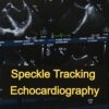 07 CME: Speckle Tracking Echocardiography (AE)