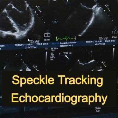 07 CME: Speckle Tracking Echocardiography (AE)